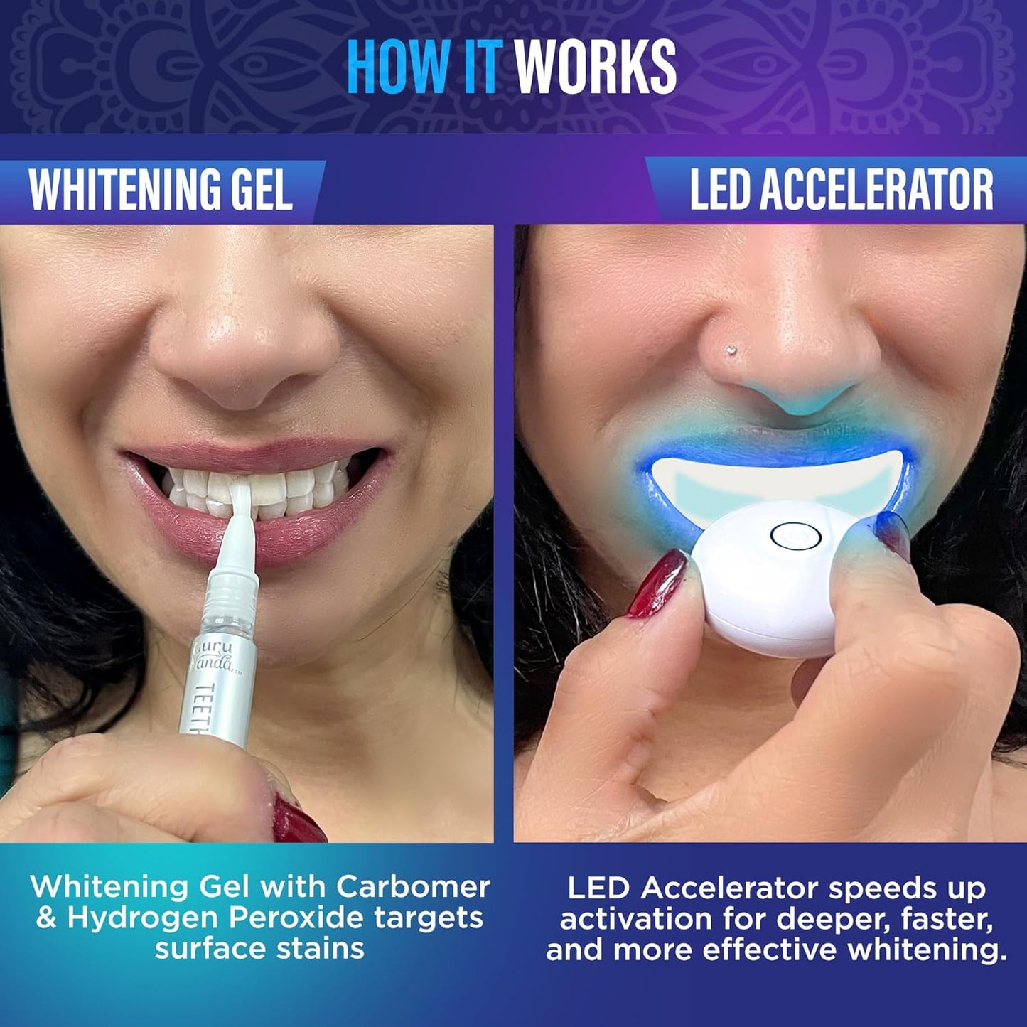 GuruNanda Wireless Teeth Whitening Kit with LED Light & Pen – Removes Coffee & Food Stains, 40 Treatments