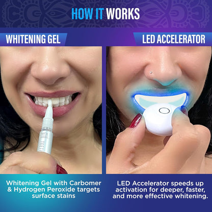 GuruNanda Wireless Teeth Whitening Kit with LED Light & Pen – Removes Coffee & Food Stains, 40 Treatments